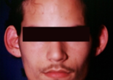 31