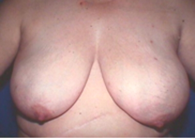 48