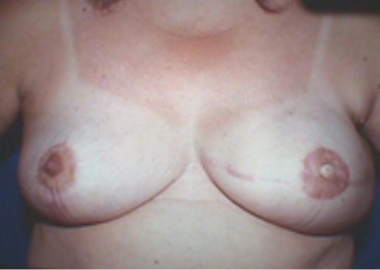 50