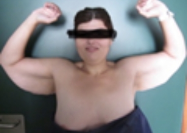 65