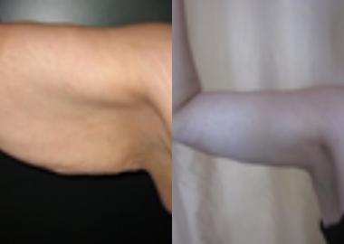 67