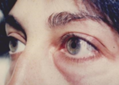 imágenes antes y después web Ricardo (5)